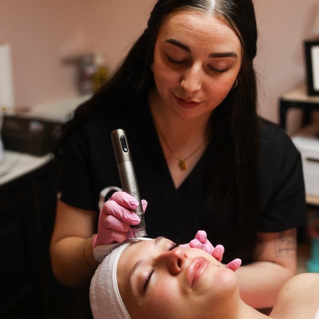 Nano needling Series at BeautybyC in Centreville, MD